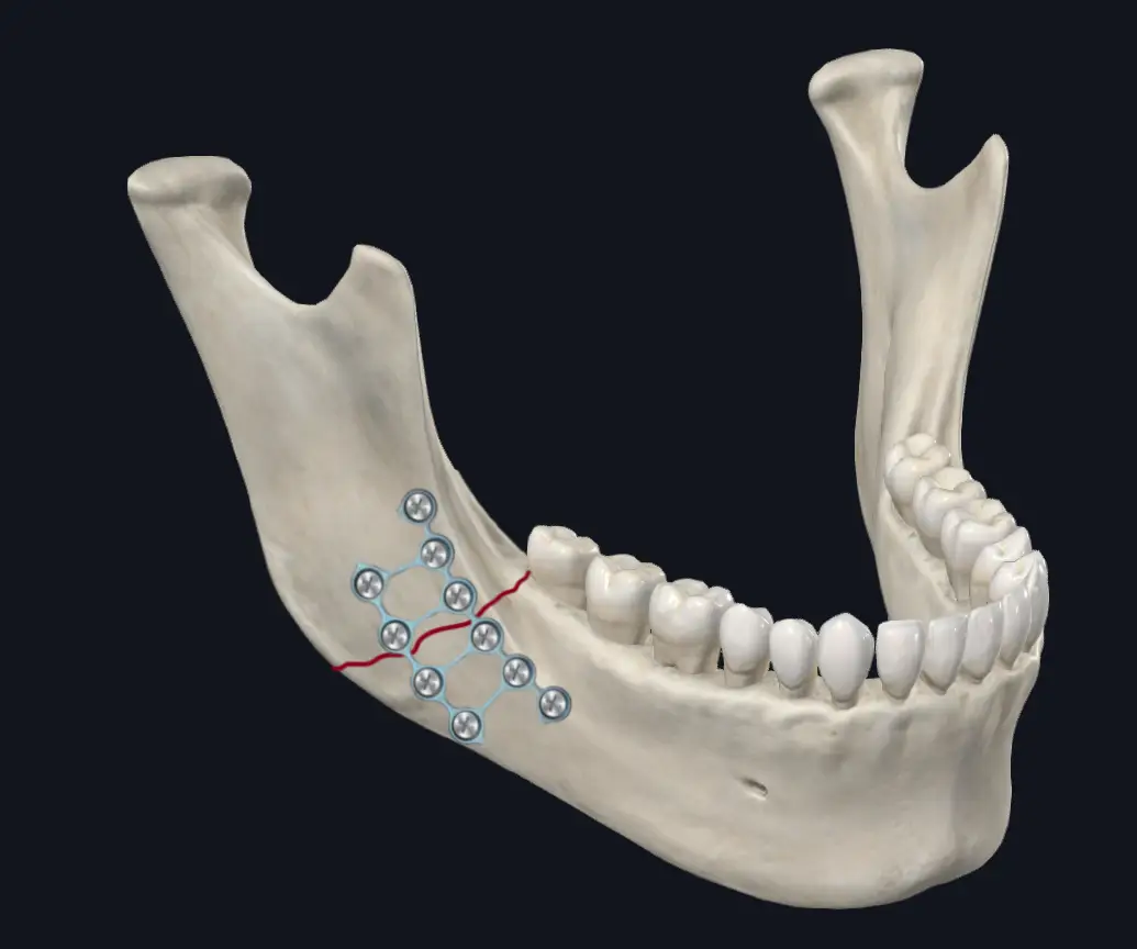 Oral Surgery
